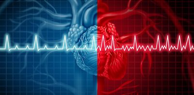 Why is obesity linked to irregular heart rhythms? Researchers found 1 potential mechanism