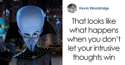 “Looking Crazy”: Man Gets Hair Transplant, Ends Up With Swollen “Megamind” Head