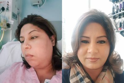Woman awarded thousands after routine tooth extraction leaves her in intensive care