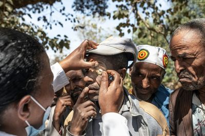 'I Rip Out My Lashes To Ease Pain': Eye Disease Afflicts Ethiopia