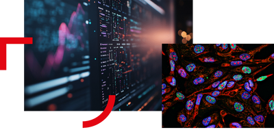 Prostate cancer and AI: the exciting advances that could transform treatment