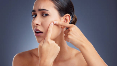 Can pimple breakouts indicate skin cancer?