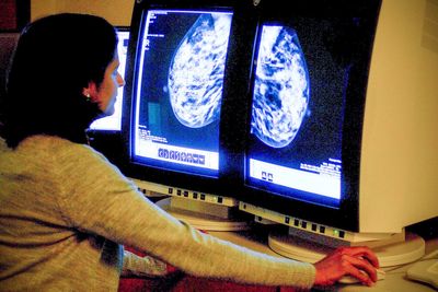 Wes Streeting announces landmark trial to harness AI to speed up breast cancer screening