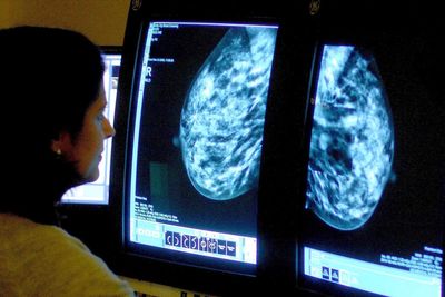 World Cancer Day 2025: early signs and symptoms of the disease and how to raise awareness
