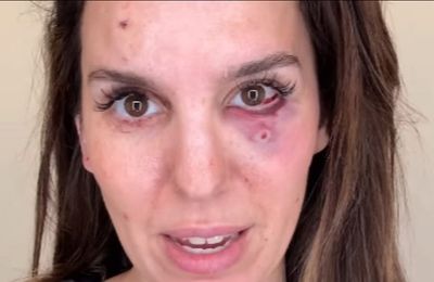 Disney star Christy Carlson Romano shot and rushed to hospital 'I'm just grateful to be alive...'