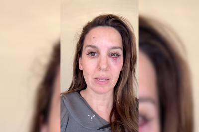 Ex-Disney star Christy Carlson Romano shot in the face during husband’s birthday party