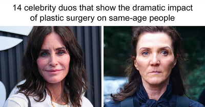 The Striking Impact Of Plastic Surgery On Same-Age Celebrities In 14 Pairs Of Photos