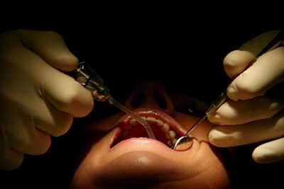 NHS dentistry is ‘very weak’, top official admits