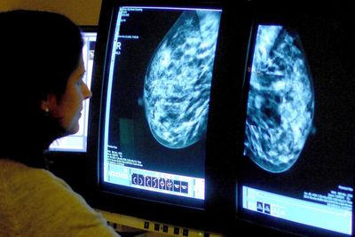 Record number of women up to date with breast screening, figures show