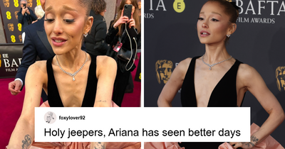 Expert Reacts To Ariana Grande’s New Viral Pic That Has People Saying She “Needs Help”