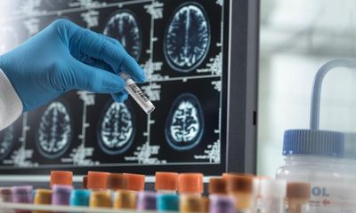 Doctored by Charles Piller review – the scandal that derailed Alzheimer’s research