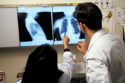 Why we're still fighting tuberculosis