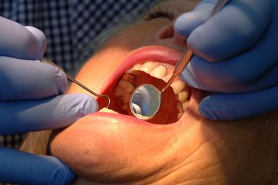 Government promises extra 700,000 dentist appointments - find out how your area benefits