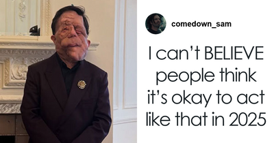 “This Is Called Accountability”: Adam Pearson Refuses To Back Down To Troll Amid “Anti-Trans” Claim