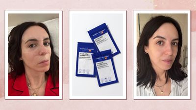 I swear by these stick-on wrinkle patches - it’s like Botox while you sleep