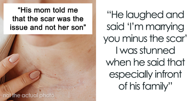 Woman Postpones Her Wedding, People Advise To Call It Off Because Of Fiancé’s Hurtful Comments