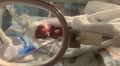 Pregnant Woman Takes Her Own Life After Extreme Morning Sickness Wouldn't Let Her Stop Vomiting: 'No One Was Listening'