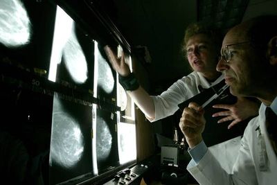 Breast cancer deaths rates for older women have been declining for years. Not anymore