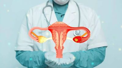 Doctor reveals 4 hidden signs of ovarian cancer - including a surprising one at mealtime