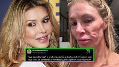 ‘Real Housewives’ Star Brandi Glanville Gives Health Update: ‘I’m Fucking Miserable’