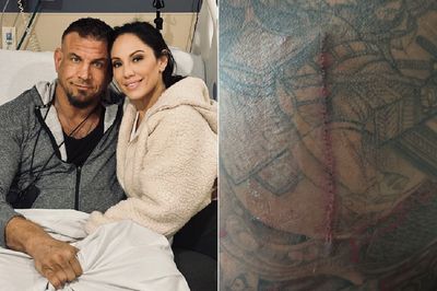 UFC veteran Frank Mir ‘committed to coming back stronger’ after emergency spinal surgery