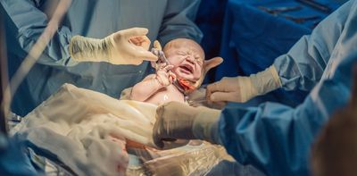 Millions of babies’ lives could be changed for the better with this one simple check