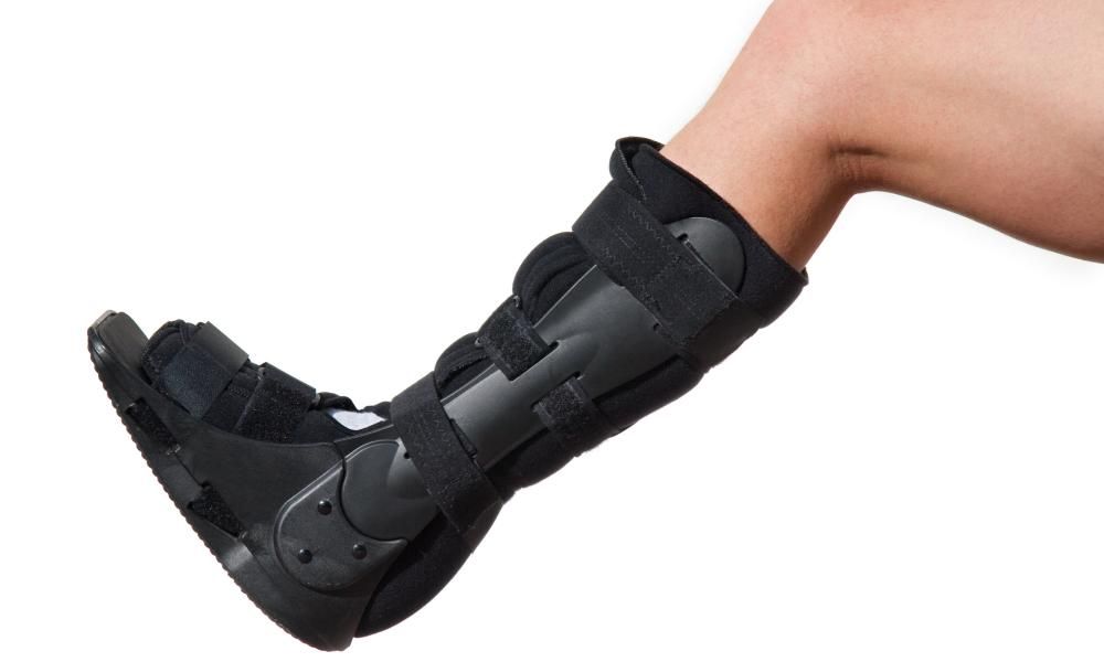I twanged my achilles playing pickleball. Here’s what…