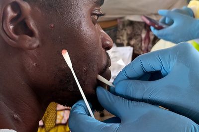 US aid cuts are hurting Africa's ability to respond to disease outbreaks, health chief says