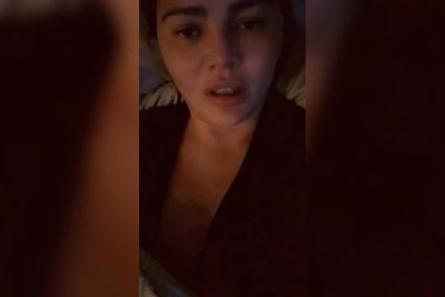 Chrissy Teigen hits back after trolls accuse her of having too much face filler