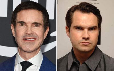 'I've gone a bit crazy with it': Jimmy Carr admits he can't stop getting 'tweakments'