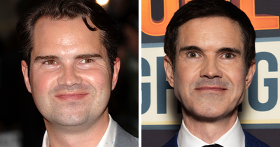 “He’s Aged 20 Years”: Jimmy Carr Admits He Can’t Stop Getting Cosmetic “Tweakments”