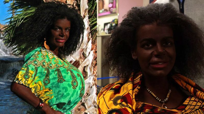 Woman Born Blonde and Fair Claims She's 'Black' After…