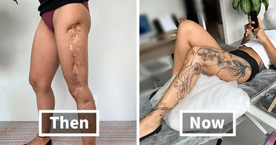 Tattoo Artist Covers Scars With Delicate Designs, And Here Are Her 30 Best Transformations