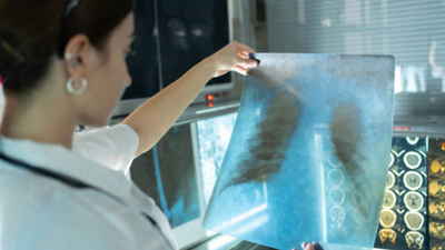 "Tuberculosis does not discriminate": How this entrepreneur turned her TB struggle into a mission