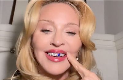 Madonna shocks fans by flaunting new teeth grill