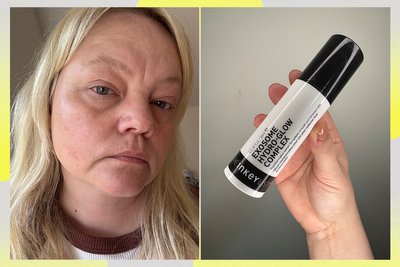 The Inkey List’s new affordable serum transformed my compromised skin