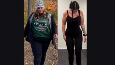 Woman battles ADHD, eating disorder and still manages to lose 72 kilos, know her inspirational story