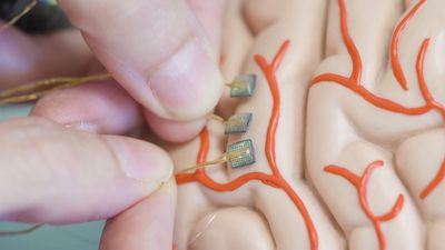 New two-way brain-computer interface has returned motion AND sensation to a paralysed test patient: 'Right now, we just know the results are significant and leading to functional and meaningful outcomes'