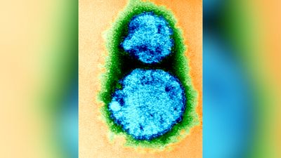 What is hantavirus? The rare but deadly respiratory illness spread by rodents