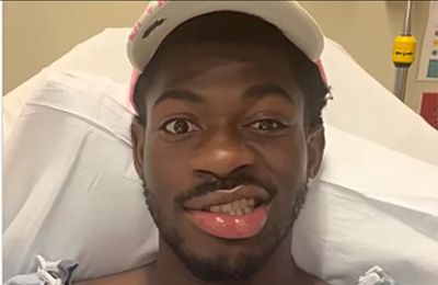 Lil Nas X hospitalised after 'losing control of right side of his face'