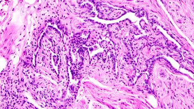 'Useless' female organ discovered over a century ago may actually support ovaries, study finds
