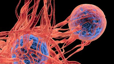 Simple blood test could reveal likelihood of deadly skin cancer returning, study suggests