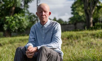A friend killed, and inquiries shelved: life fighting the stigma of albinism in Malawi