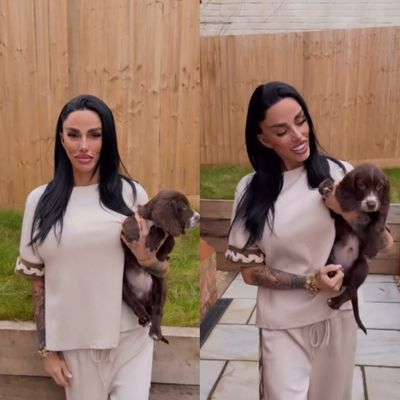 Is Katie Price Sick? Very Taut Skin Fuels Health Scares Among Followers