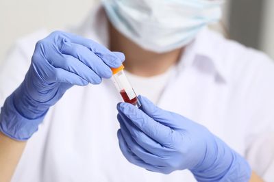 New NHS blood test can pick up 12 types of cancers