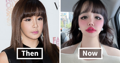 “Needs Therapy”: K-Pop Star Horrifies With Drastic Transformation Amid Plastic Surgery Rumors