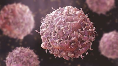 Cancer: Facts about the diseases that cause out-of-control cell growth