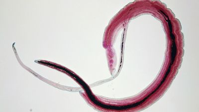 Parasitic worm raises risk of cervical cancer, study finds