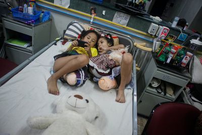 2 girls survived Nepal's 2015 earthquake. Each lost a leg, but found friendship in the hospital