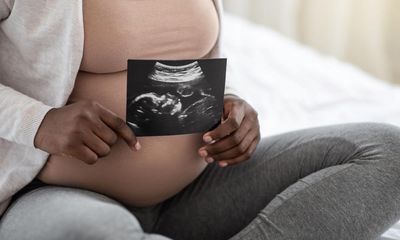 NHS in England failing to record ethnicity of those who sue over maternity care